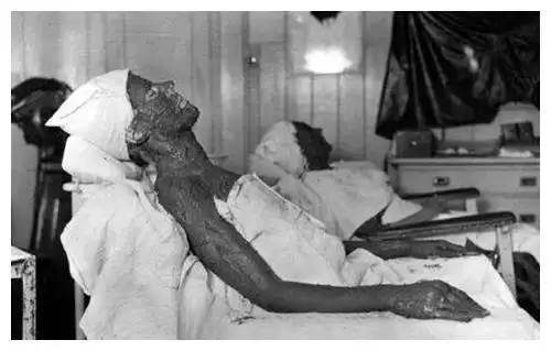 25岁女孩离世5年被开棺尸骨发出渗人荧光死前曾遭到巨大折磨