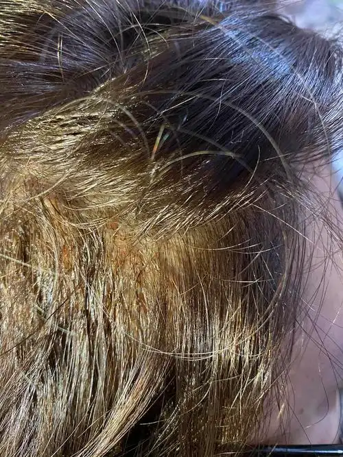 染黑改色,改色是改色成功,但是头皮糊的一大堆东西是什么