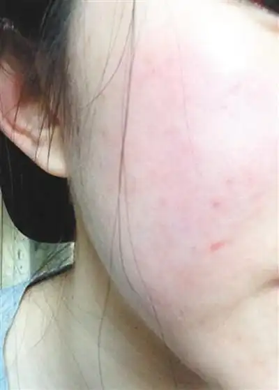 重庆女子被闺蜜坑惨 春节根本"没脸见人"_新浪重庆_新浪网