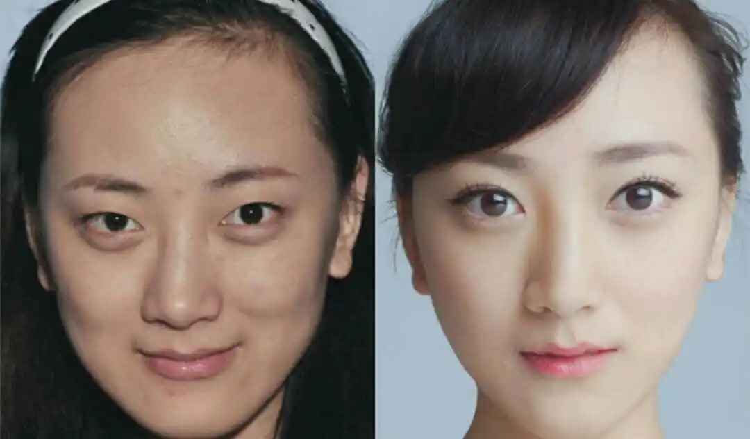 近日,网曝多人整容对比图片.网友直呼变脸如换头,完全不是一个人.