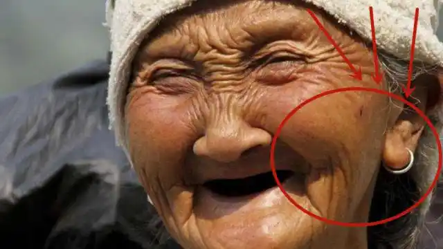 老人说耳垂大的人更长寿?听听老中医怎么说,真相让人哭笑不得