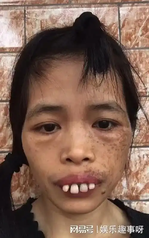 广西奇葩网红梅梅靠奇丑长相一夜成名圈粉百万她到底有何魅力