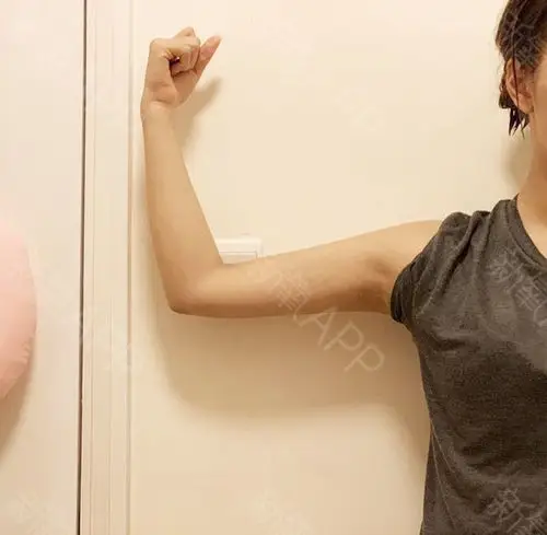 我又来分享了~ 吸脂4个月的手臂,上臂吸完很瘦了,_圈子-新氧美容整形