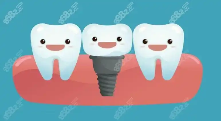 这是种植牙卡通图