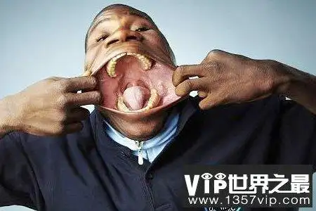 世界上最大的嘴,嘴巴最大的人(宽17厘米)