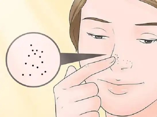 面部四种常见皮肤病治疗实用锦囊