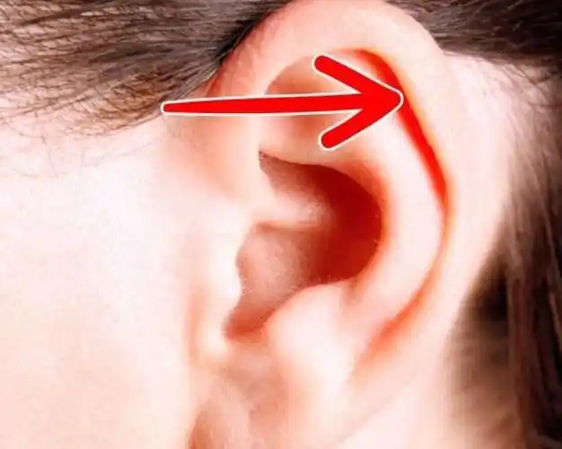 达尔文点:耳轮上部内缘的一个小突起,可以聚集很遥远的声音,很多人