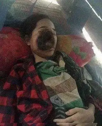 恭城家长必看!只因小时候一颗虫牙,16岁女孩眼珠子整个往下掉