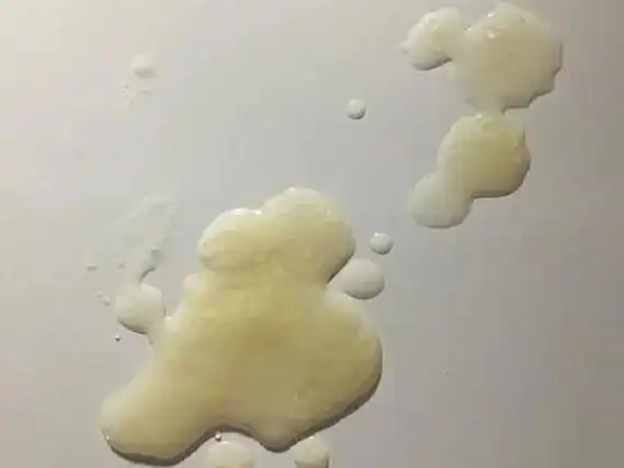 哪里好!精子颜色"心潮起伏"-第2张图片-帕西博客