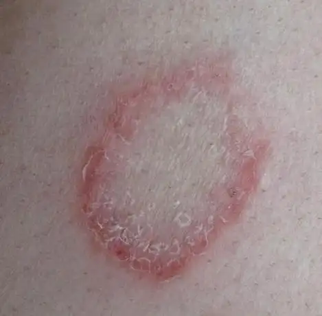 艾滋病的传播途径有什么