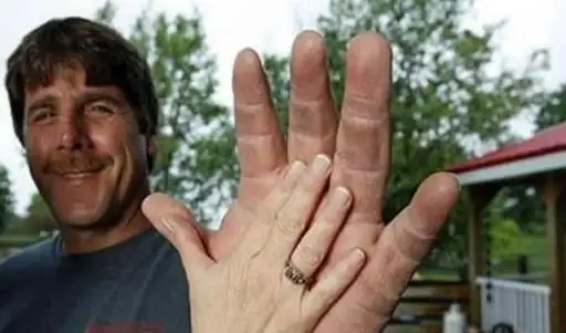 来自美国52岁的杰夫达比拥有世界上最大的手掌,他的小臂粗达49厘米,被