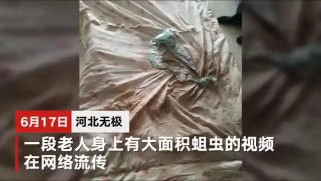 触目惊心!敬老院老人浑身溃烂生蛆,足跟伤口深可见骨