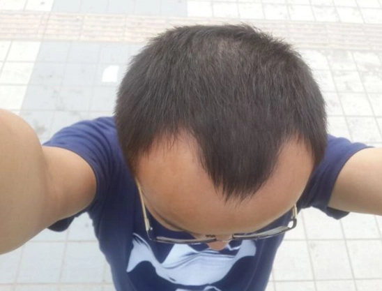 有句俗语说得好"一切从头开始",一头乌黑浓密的头发不仅是健康的