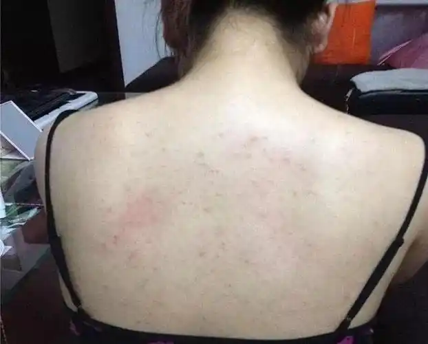 洗澡不宜频繁(选择合适的沐浴用品)-百科-8s新商盟