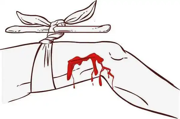 意外受伤出血创可贴纱布止血带该怎么用