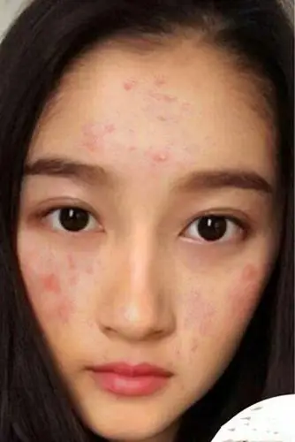 女星卸妆实在是太丑了!迪丽热巴上榜!