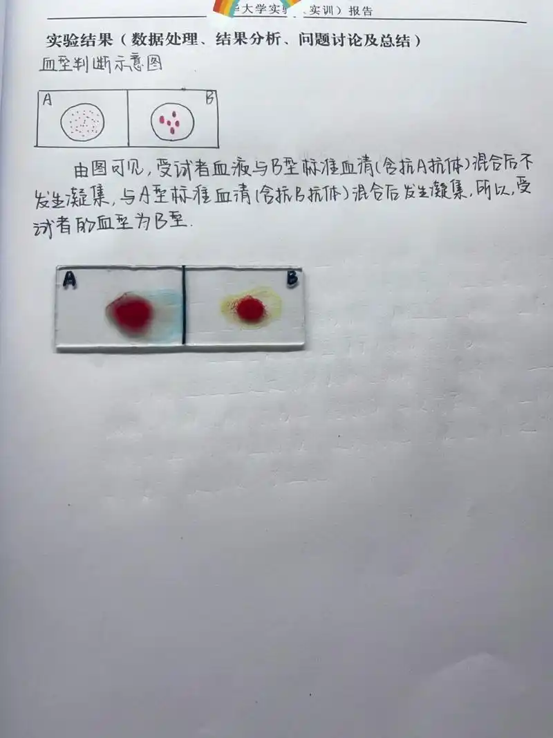 abo血型鉴定实验报告