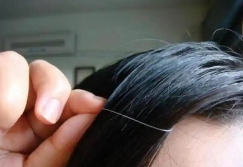 经常拔白头发有什么危害揭开真相