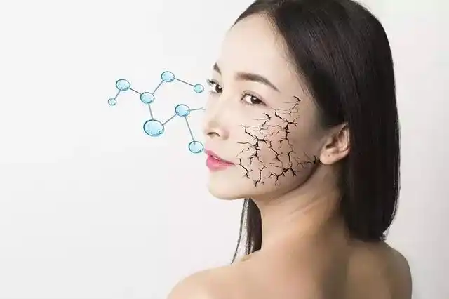 冬季皮肤干到掉渣?不只缺水那么简单!这些习惯不改,当心你的脸