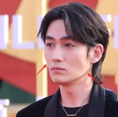 北京电影节朱一龙疤痕明显林志玲太尴尬有人脸肿有人整容