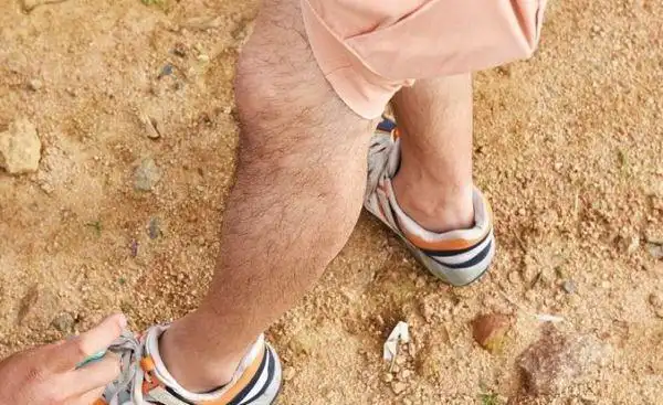 男性腿毛少是怎么回事?提醒:可能这3种原因导致,涨知识了
