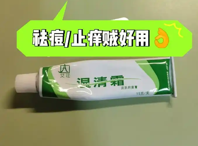 祛痘又止痒的中药草本药膏