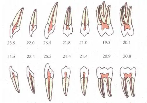 图源:《根管治疗临床指南》2,根管清洁,消毒麻醉生效后,医生会在牙
