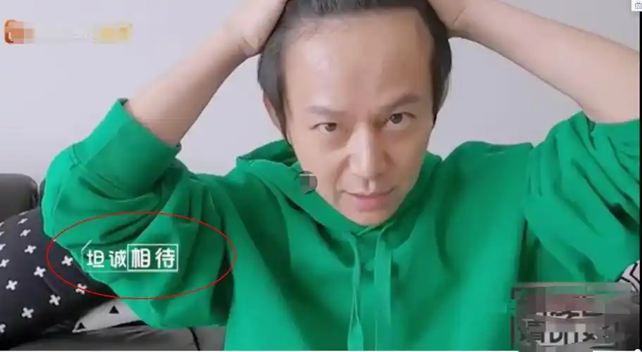 何炅节目中掀起刘海,发际线高得吓人,不老神话破灭!