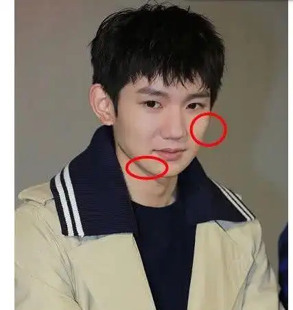 王源素颜出席发布会脸上痘痘清晰可见网友还在青春期啊