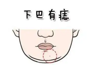 3颗发财痣长在什么位置 3颗发财痣长在什么位置比较好