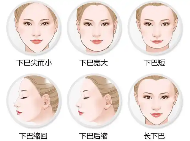 一个下巴会有多大改变?