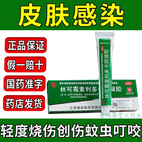 林可霉素利多卡因凝胶20g 蚊虫叮咬止痒烧烫伤膏软膏绿药膏老牌子