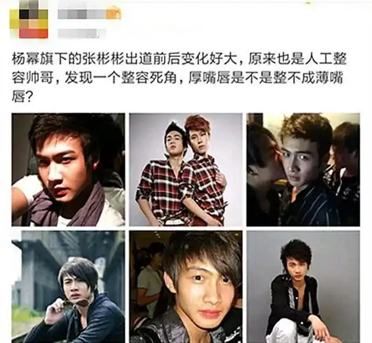 对比张彬彬往今的照片,五官变化最大的可能是嘴唇了,16岁的张彬彬嘴唇