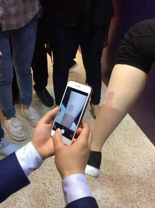 "智能皮肤"pk专业医生