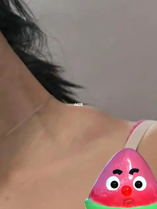 斜方肌这里为啥这样啊?救命!