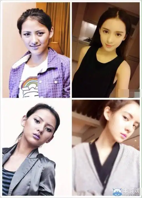 王思聪女友张予曦被爆曾整容整容前后对比照曝光