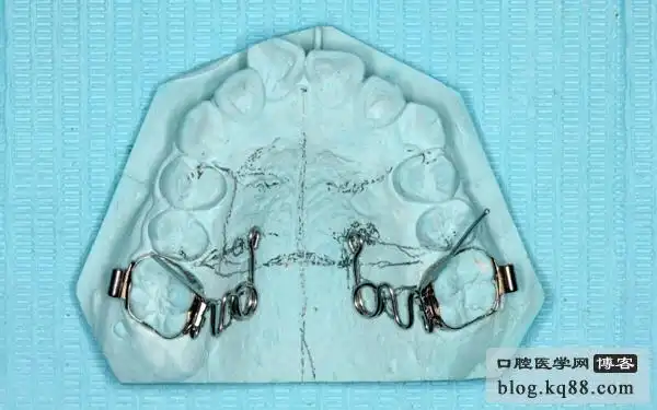 8 弯制两侧摆簧9 调试摆簧10 弯制固定卡环,用