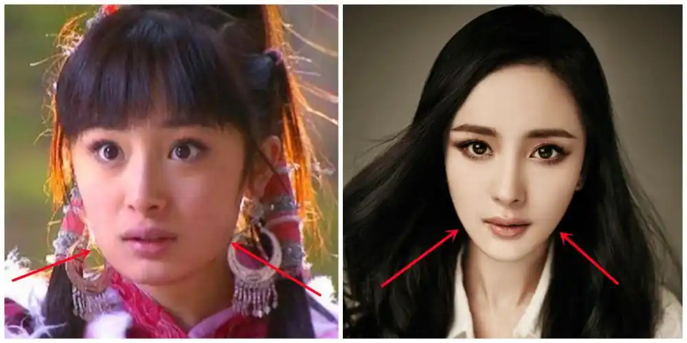 到现在v字尖下颌"鹅蛋脸"的顶流icon,有关杨幂"疑似削骨磨腮,脸型轮廓