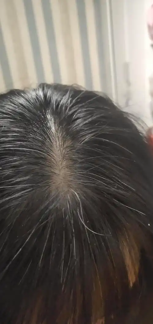 好多白发,米诺已用半个月