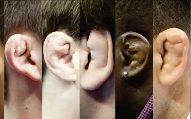 摔柔选手的饺子菜花耳中蕴含着什么