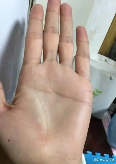 金星丘有痣的,有同情心,而且自身的桃花运. 来自运来玄道 - 微博