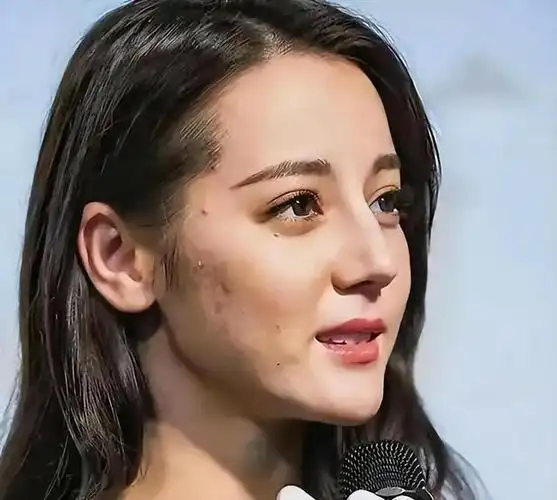 生图下的女明星,不见的都天生丽质,痘痘肌,小肚腩都很常见