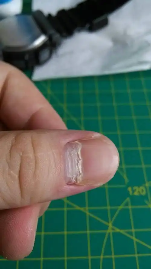 一个月前在指甲根部长出来的!