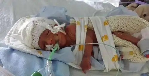 夫妻每天坚持为6个月的早产儿拍照, 2个月后迎来振奋消息!