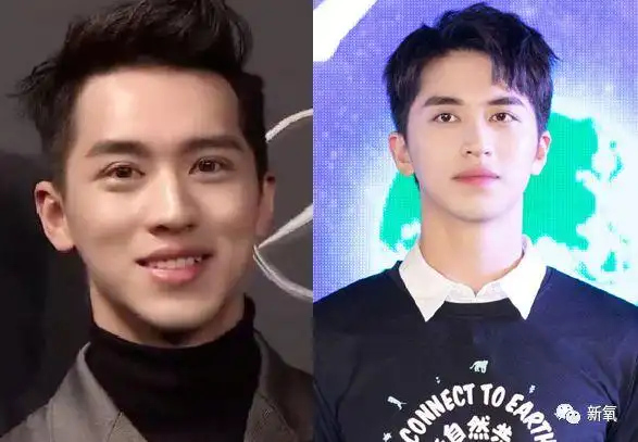 最近羊惊奇地发现,他竟然和景甜一样,去修复双眼皮惹!