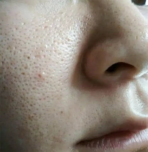 有没有人像我一样开始化妆之后毛孔变得粗大,皮肤黯淡无光,姐妹都是