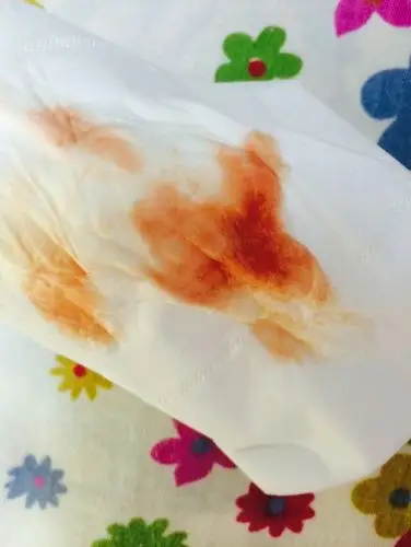 出这种颜色的血宝妈们有这样的吗