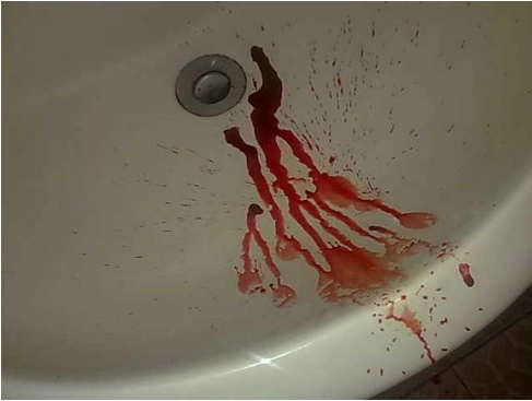 男子浴室服药割颈,即将入狱担忧2岁女儿没人照顾