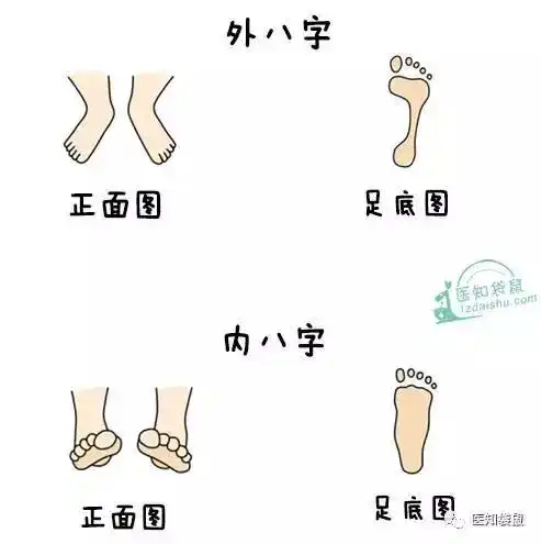 宝宝学走路,踮脚尖,内外八字.哪些姿势异常要警惕?
