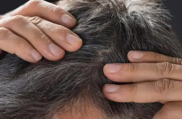 白发长在哪,病就在哪出?长在前额,两鬓,后脑勺,分别代表啥?